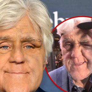 Jay Leno Looking Better After Nasty Fall Did Serious Damage to His Face