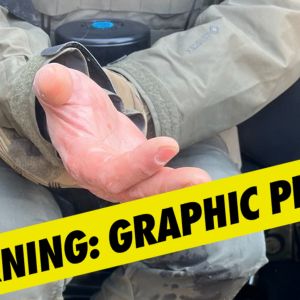 Homeland Security Assistant Secretary Claims Rioters Bit Off Agent's Finger in Minnesota