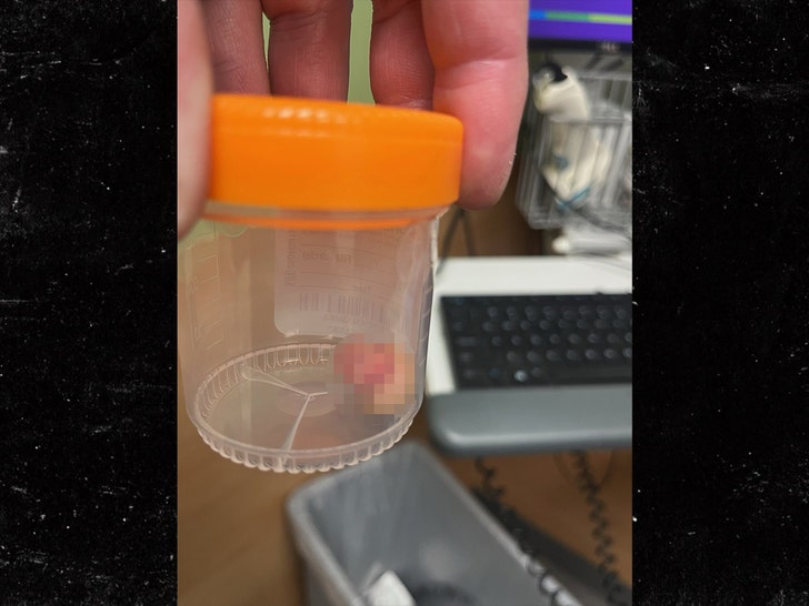 hsi officer finger x SUB