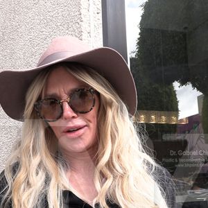 Brandi Glanville Says Breast Implants Caused Face Parasite