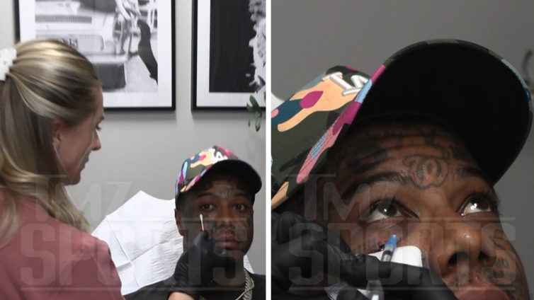 Blueface Gets Injury Fixed After Taking Elbow to Face in Sparring Session