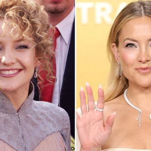 Kate Hudson Good Genes or Good Docs?!