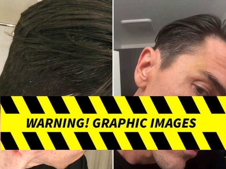 Tom Sandoval Alleged Injuries From Victoria Lee Robinson