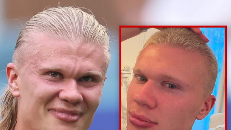 Erling Haaland Buzzes Off Iconic Blonde Hair