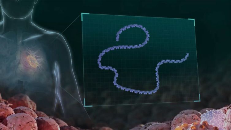 Cancer vaccine prevents deadly melanoma from returning or spreading in landmark trial
