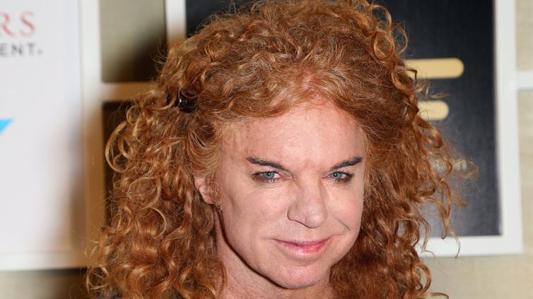 Carrot Top Suffered Suspected Overdose From Prescription Pills Before Hospitalization