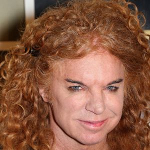Carrot Top Suffered Suspected Overdose From Prescription Pills Before Hospitalization