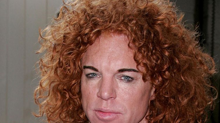 Carrot Top Reportedly Doing Better, Released From Hospital